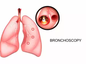 Бронхоскопия – кога, как, защо