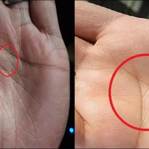 What Does it Mean if you Have the Letter X on your Palm?