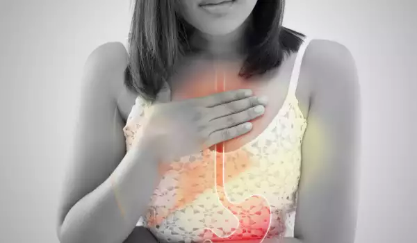 gastritis reflux